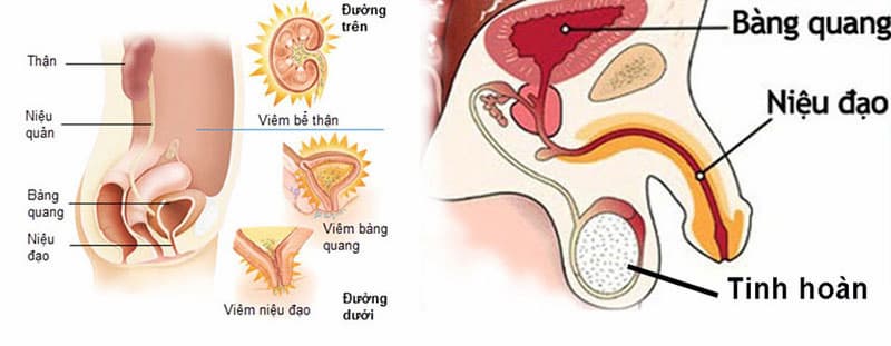 Các dấu hiệu, triệu chứng hay gặp ở bệnh viêm niệu đạo